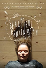 My Beautiful Broken Brain (2014)